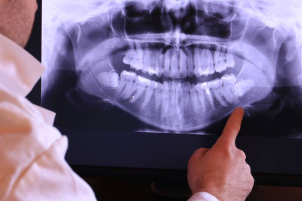 Best Emergency Root Canal Treatment in Downs, IL